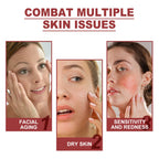 RUVIAA BEAUTY Collagen Membrane Facial Mask Set – Soluble Cheek & Forehead Patches for Smile Lines & Skin Tightening