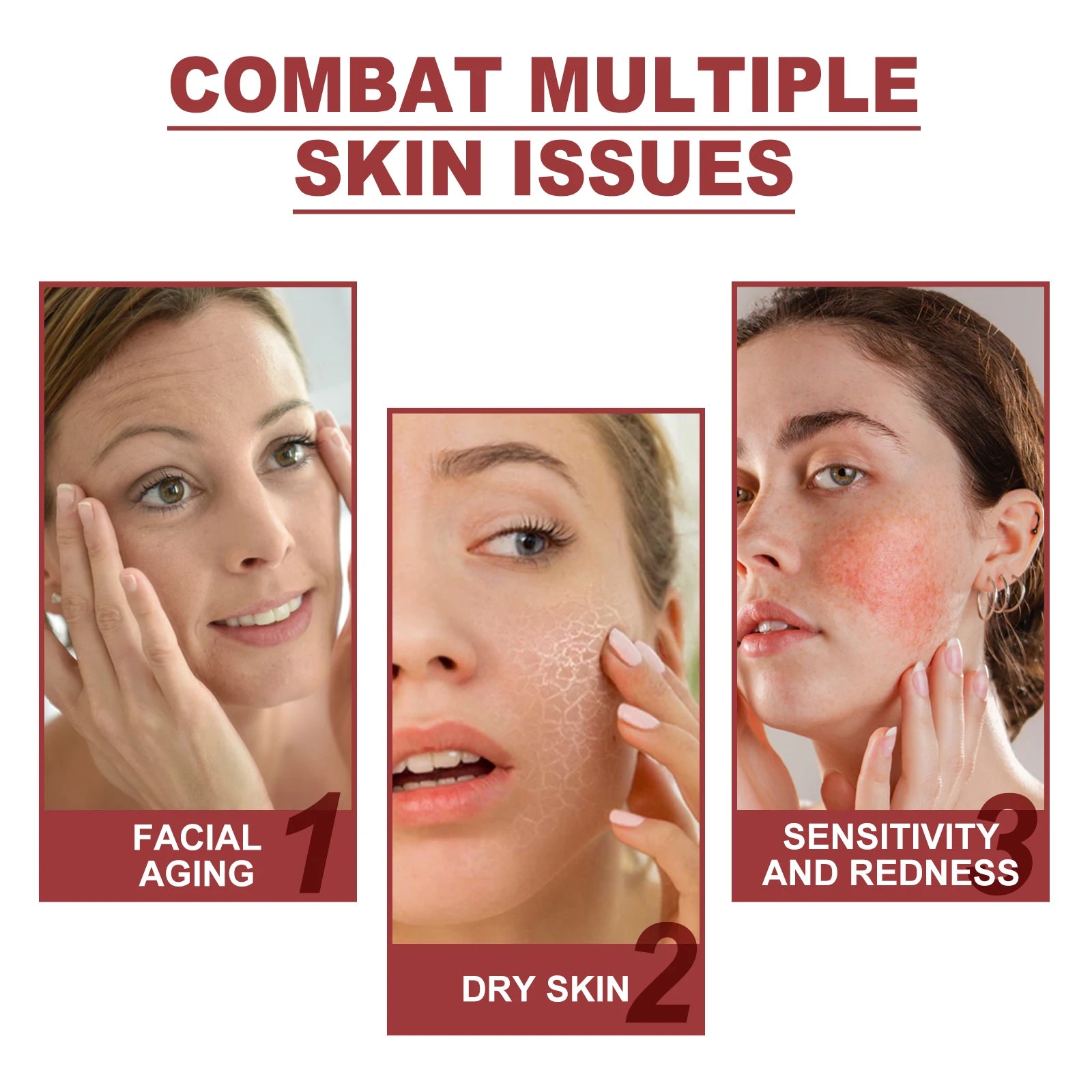 RUVIAA BEAUTY Collagen Membrane Facial Mask Set – Soluble Cheek & Forehead Patches for Smile Lines & Skin Tightening