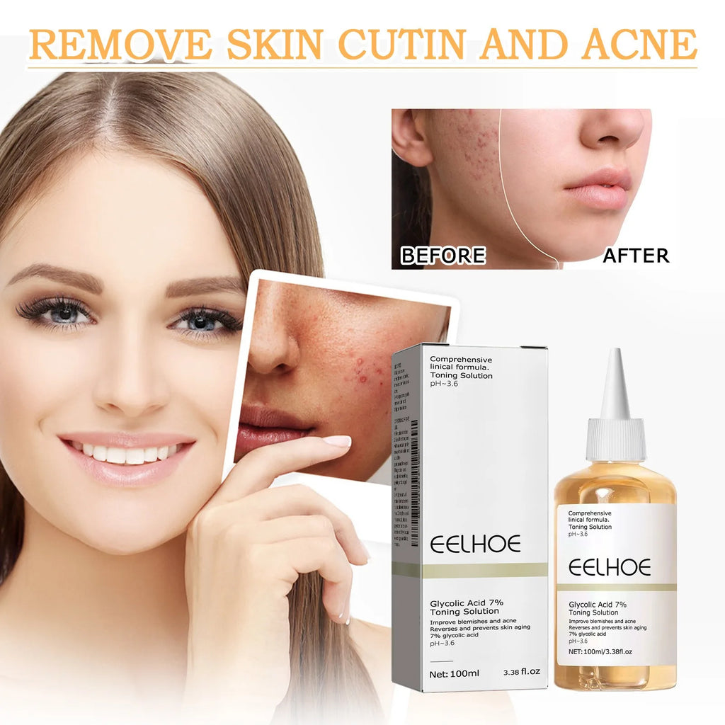 Glycolic Acid 7% Toning Solution Ordinary Acne Remover Lifting Firming Wrinkles Glowing Facial Skin Care Glycolic Acid Toner