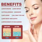 RUVIAA BEAUTY Collagen Membrane Facial Mask Set – Soluble Cheek & Forehead Patches for Smile Lines & Skin Tightening