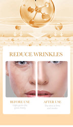 RUVIAA BEAUTY 10PCS Collagen Anti-Wrinkle Facial Mask – Anti-Aging, Firming & Brightening Skincare