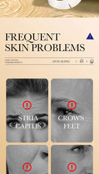 RUVIAA BEAUTY 10PCS Collagen Anti-Wrinkle Facial Mask – Anti-Aging, Firming & Brightening Skincare