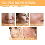 Glycolic Acid 7% Toning Solution Ordinary Acne Remover Lifting Firming Wrinkles Glowing Facial Skin Care Glycolic Acid Toner