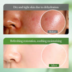 BIOAOUA Soothing Aloe Vera Gel For Face & Body Hydrating Moisturizing Repairing Sunburn Relief Acne Care For Sensitive Skin